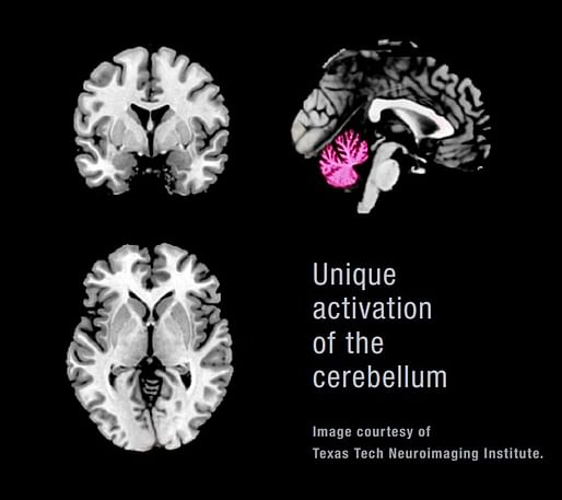 The study analyzed the brain maps generated by viewing four types of imagery—positive, negative, neutral, and Sky Factory’s Open Sky Compositions. 