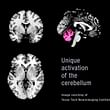 The study analyzed the brain maps generated by viewing four types of imagery—positive, negative, neutral, and Sky Factory’s Open Sky Compositions. 